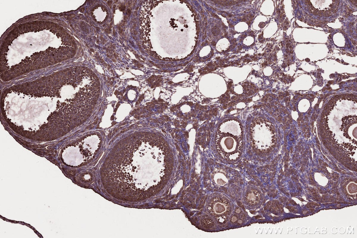Immunohistochemistry (IHC) staining of mouse ovary tissue using DOCK4 Polyclonal antibody (21861-1-AP)
