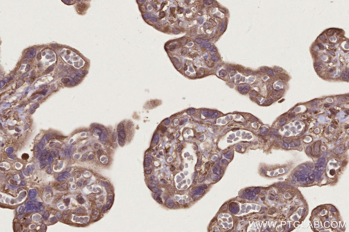 Immunohistochemistry (IHC) staining of human placenta tissue using DOCK4 Polyclonal antibody (21861-1-AP)
