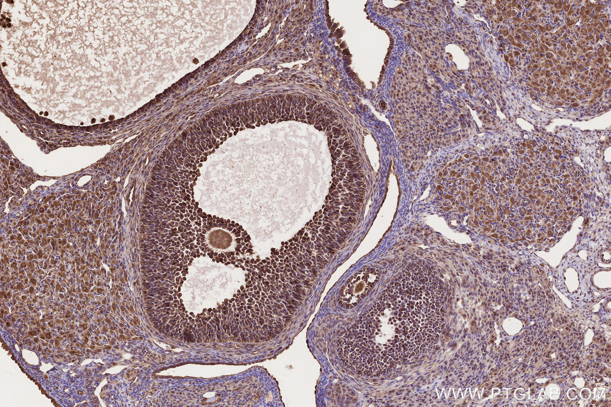 Immunohistochemistry (IHC) staining of rat ovary tissue using DOCK4 Polyclonal antibody (21861-1-AP)
