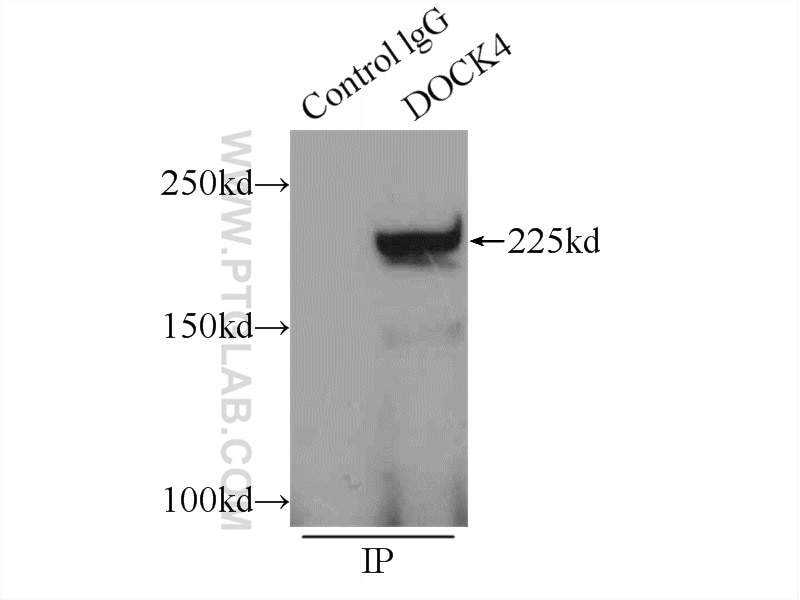 Immunoprecipitation (IP) experiment of HeLa cells using DOCK4 Polyclonal antibody (21861-1-AP)