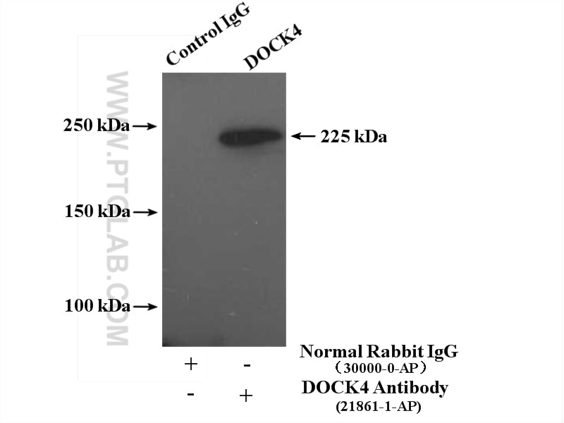 Immunoprecipitation (IP) experiment of HEK-293T cells using DOCK4 Polyclonal antibody (21861-1-AP)