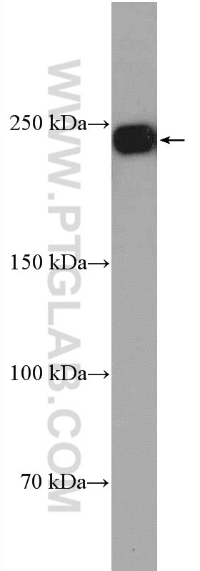 WB analysis of HEK-293 using 21861-1-AP