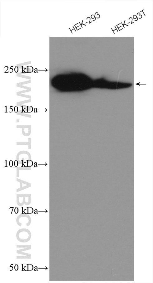 Western Blot (WB) analysis of various lysates using DOCK4 Polyclonal antibody (21861-1-AP)