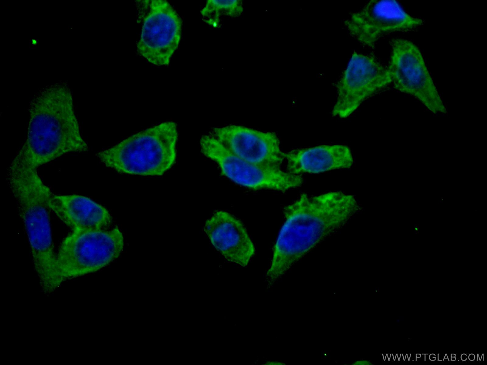 Immunofluorescence (IF) / fluorescent staining of HeLa cells using DOCK4 Polyclonal antibody (27151-1-AP)