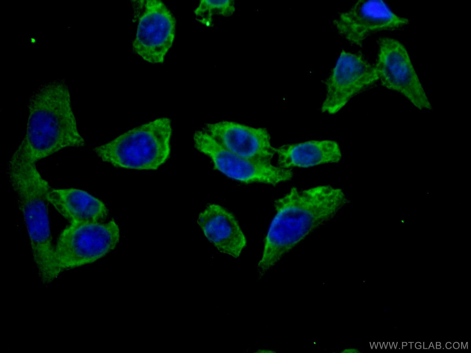 IF Staining of HeLa using 27151-1-AP