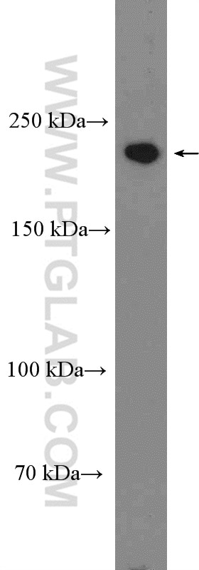 Western Blot (WB) analysis of HEK-293T cells using DOCK4 Polyclonal antibody (27151-1-AP)