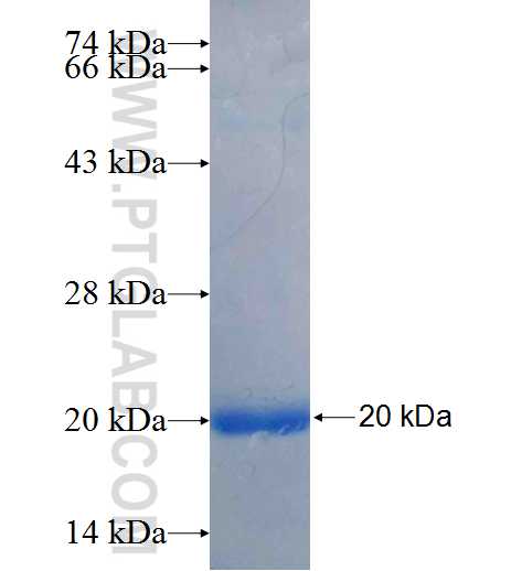 DOCK4 fusion protein Ag25965 SDS-PAGE