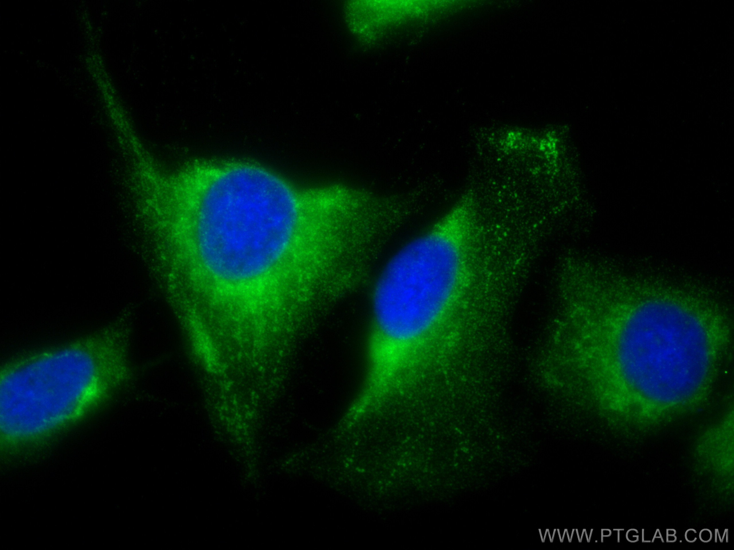 Immunofluorescence (IF) / fluorescent staining of U2OS cells using DOCK5 Polyclonal antibody (29938-1-AP)