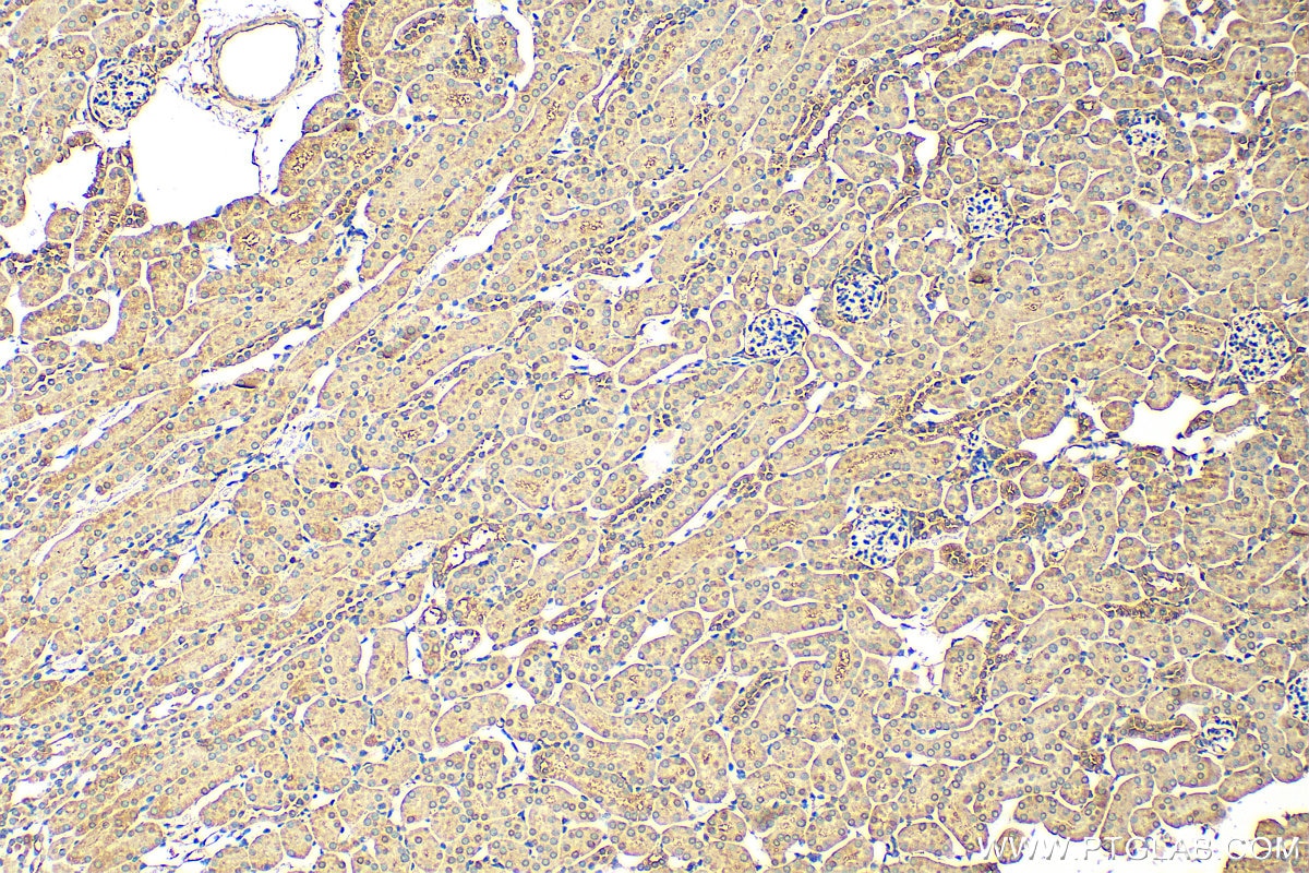 Immunohistochemistry (IHC) staining of mouse kidney tissue using DOCK5 Polyclonal antibody (29938-1-AP)