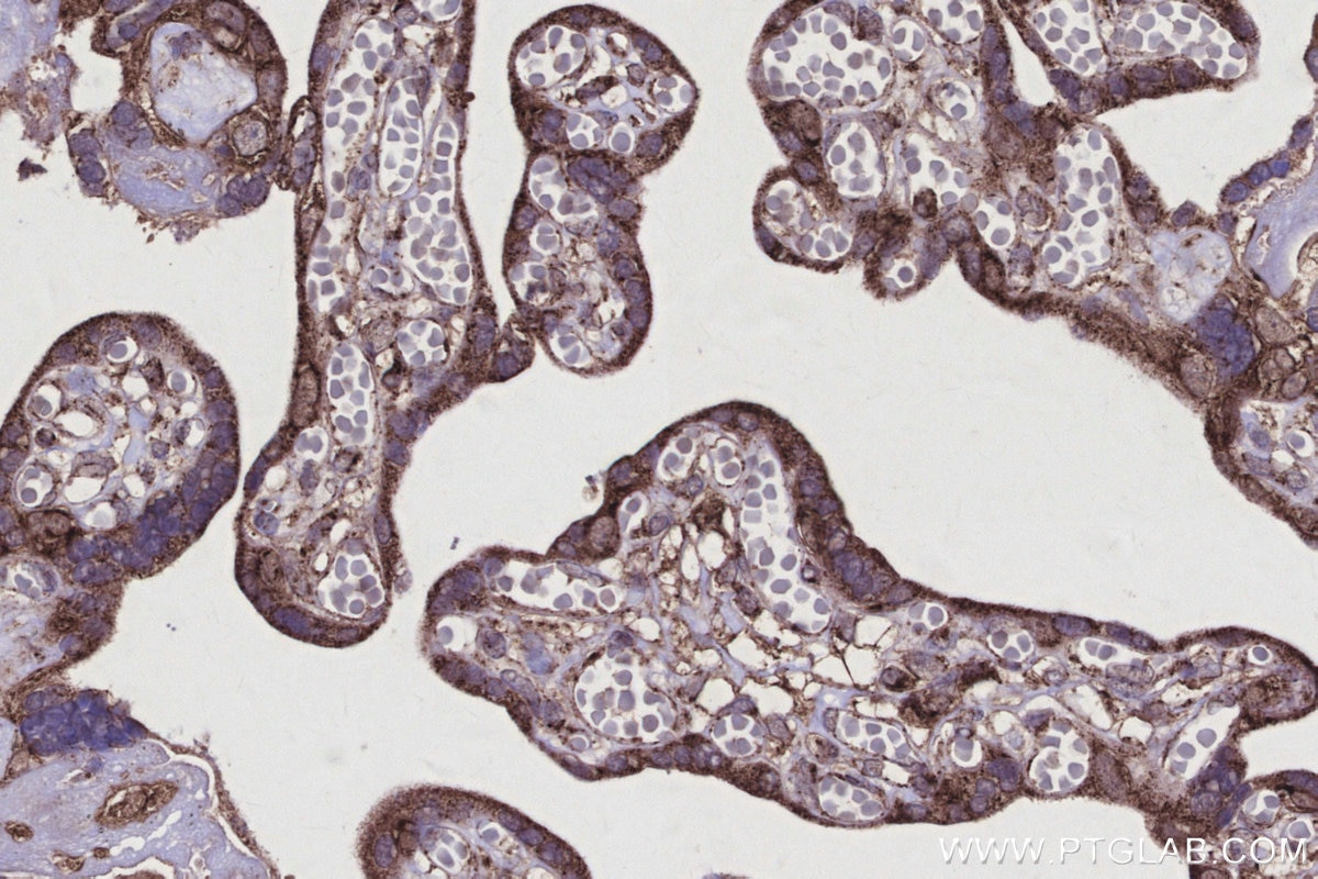 Immunohistochemistry (IHC) staining of human placenta tissue using DOCK5 Polyclonal antibody (29938-1-AP)