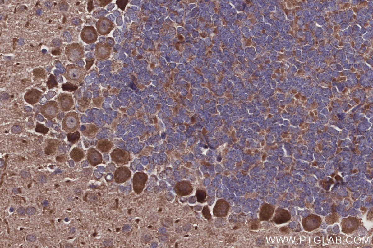 Immunohistochemistry (IHC) staining of mouse cerebellum tissue using DOCK5 Polyclonal antibody (29938-1-AP)