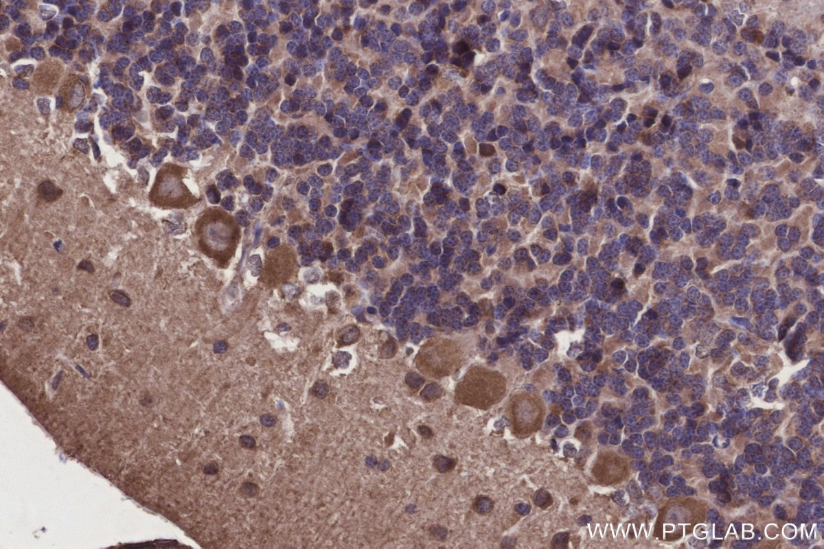 Immunohistochemistry (IHC) staining of rat cerebellum tissue using DOCK5 Polyclonal antibody (29938-1-AP)