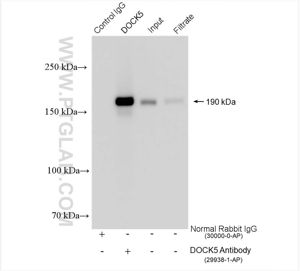 Immunoprecipitation (IP) experiment of DU 145 cells using DOCK5 Polyclonal antibody (29938-1-AP)