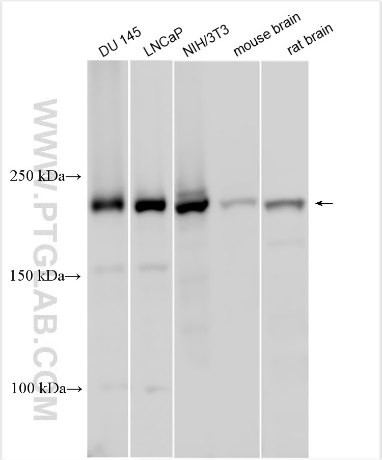 Western Blot (WB) analysis of various lysates using DOCK5 Polyclonal antibody (29938-1-AP)