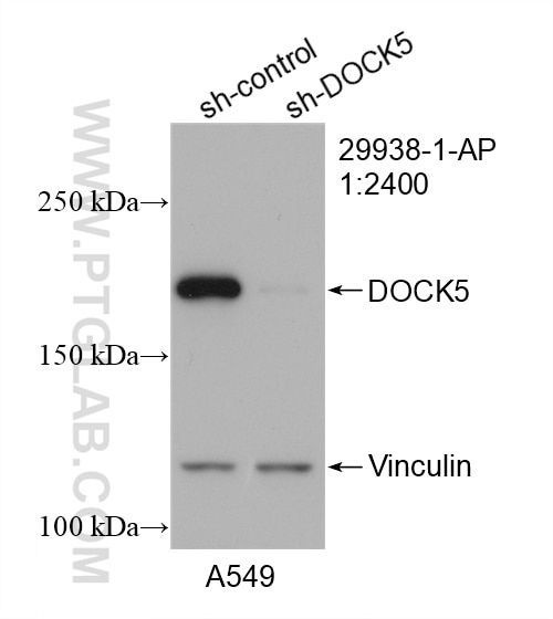 Western Blot (WB) analysis of A549 cells using DOCK5 Polyclonal antibody (29938-1-AP)