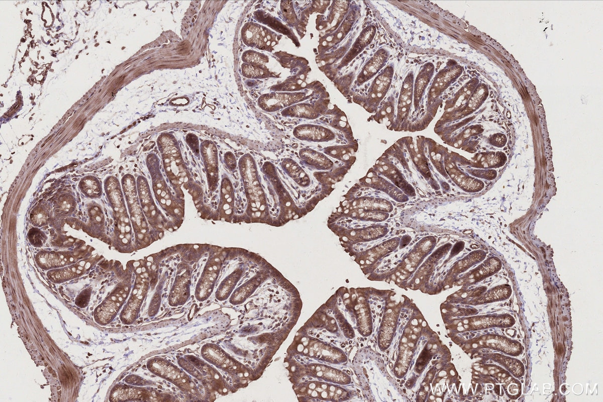 IHC staining of mouse colon using 25087-1-AP Immunohistochemistry (IHC) staining of mouse colon tissue using DOCK6 Polyclonal antibody (25087-1-AP)