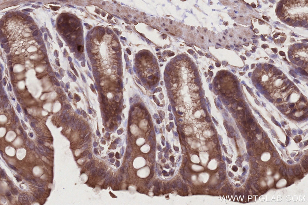 IHC staining of mouse colon using 25087-1-AP Immunohistochemistry (IHC) staining of mouse colon tissue using DOCK6 Polyclonal antibody (25087-1-AP)