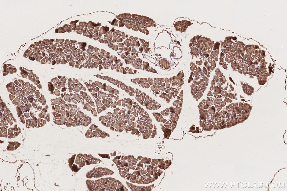 IHC staining of mouse pancreas using 25087-1-AP Immunohistochemistry (IHC) staining of mouse pancreas tissue using DOCK6 Polyclonal antibody (25087-1-AP)