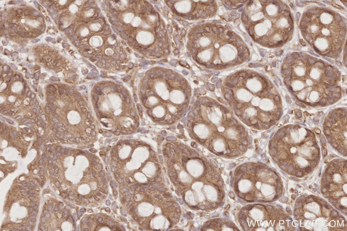 IHC staining of rat colon using 25087-1-AP Immunohistochemistry (IHC) staining of rat colon tissue using DOCK6 Polyclonal antibody (25087-1-AP)