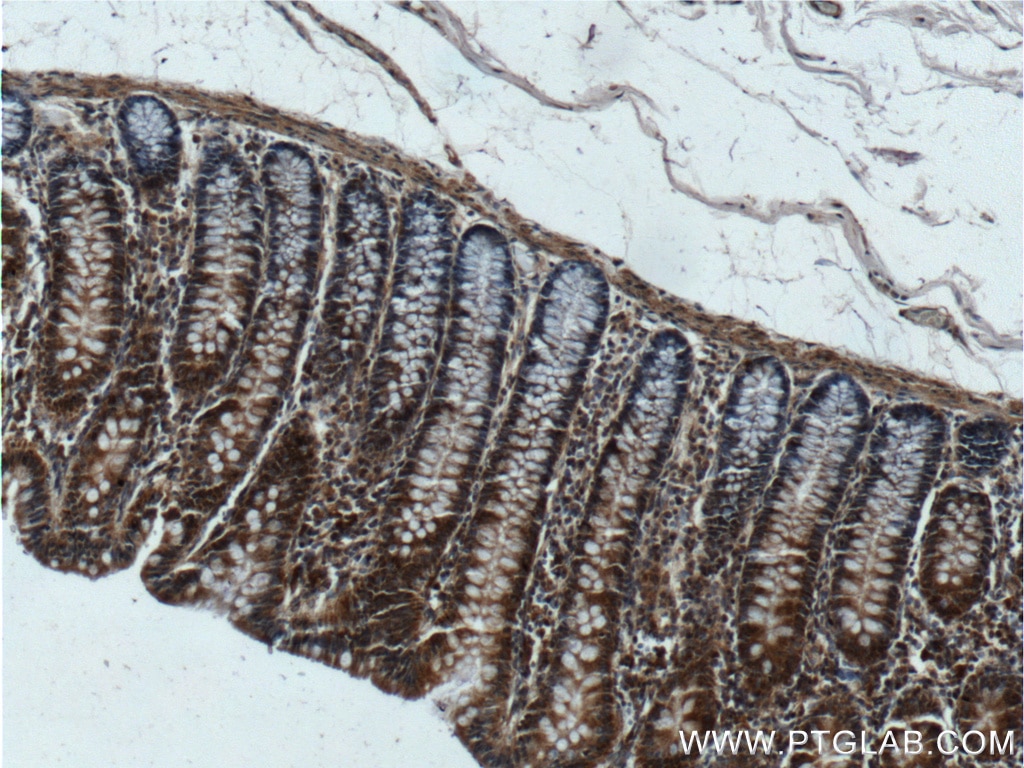 Immunohistochemistry (IHC) staining of human colon tissue using DOCK6 Polyclonal antibody (25087-1-AP)