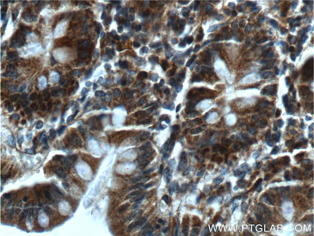 Immunohistochemistry (IHC) staining of human colon tissue using DOCK6 Polyclonal antibody (25087-1-AP)