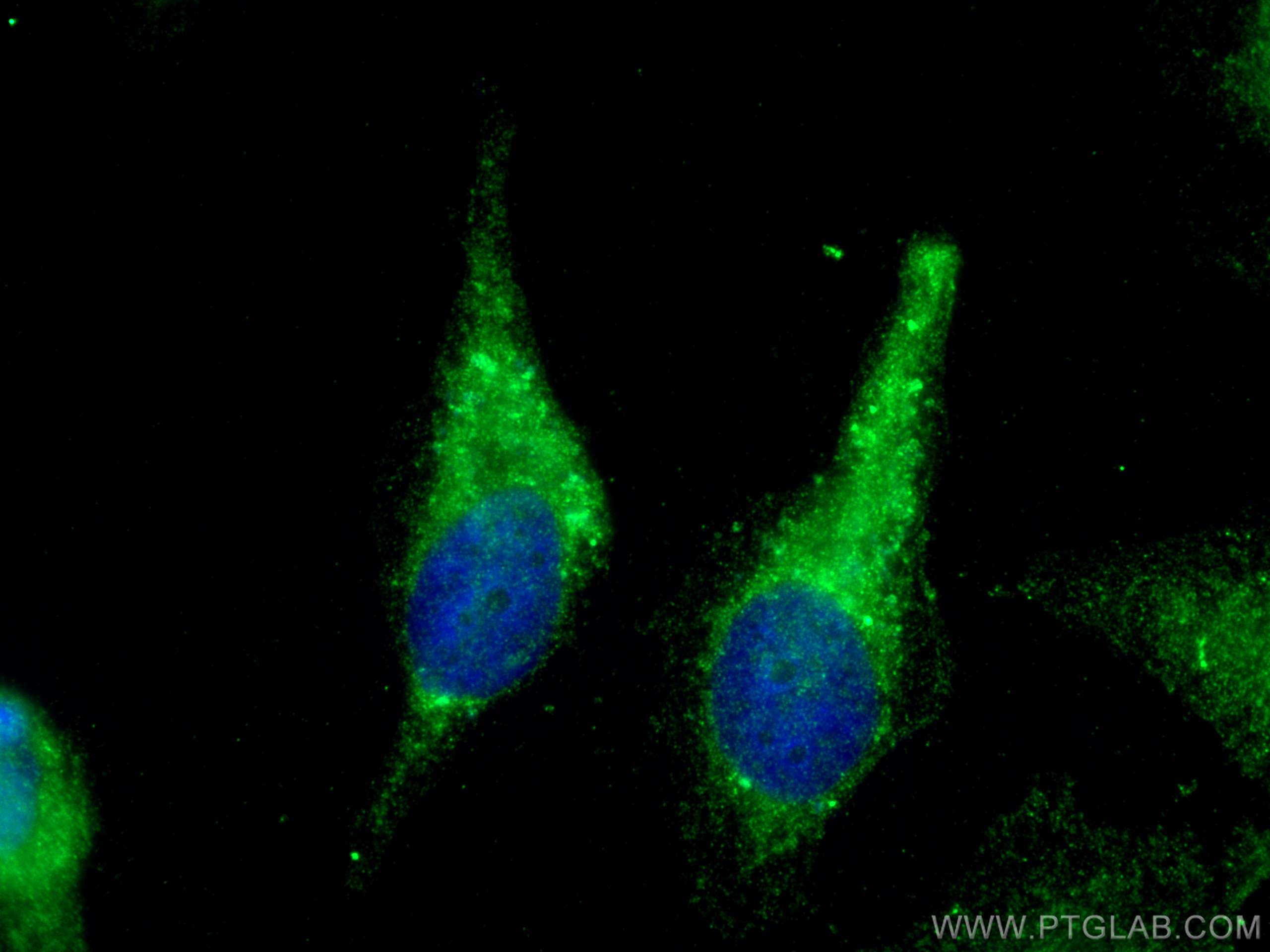 Immunofluorescence (IF) / fluorescent staining of HeLa cells using DOCK7 Polyclonal antibody (13000-1-AP)