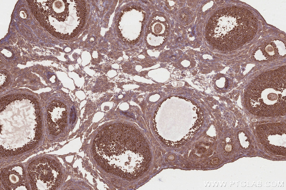 Immunohistochemistry (IHC) staining of mouse ovary tissue using DOCK7 Polyclonal antibody (13000-1-AP)