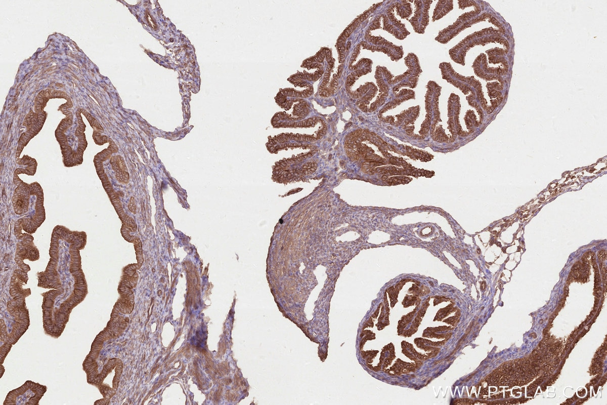Immunohistochemistry (IHC) staining of mouse ovary tissue using DOCK7 Polyclonal antibody (13000-1-AP)