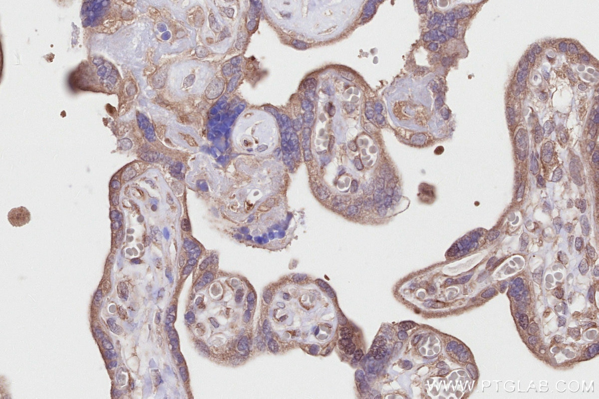 Immunohistochemistry (IHC) staining of human placenta tissue using DOCK7 Polyclonal antibody (13000-1-AP)