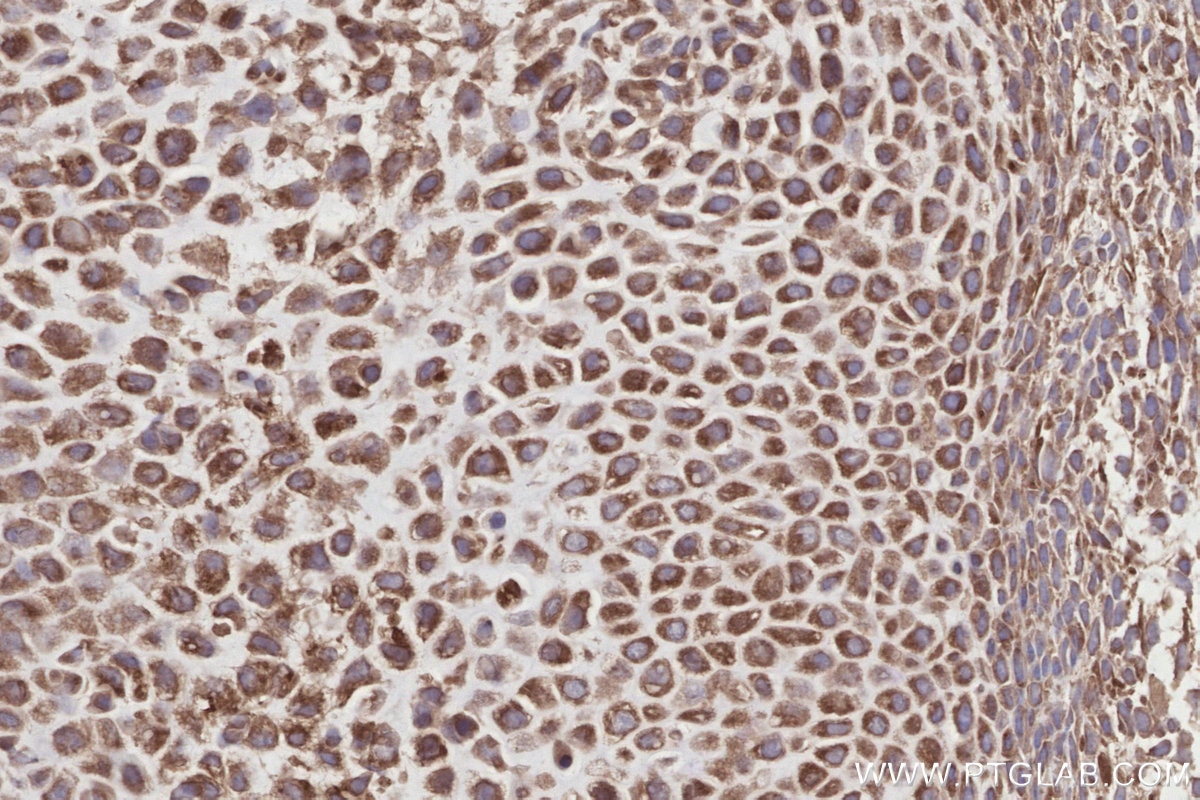 Immunohistochemistry (IHC) staining of mouse embryo tissue using DOCK7 Polyclonal antibody (13000-1-AP)