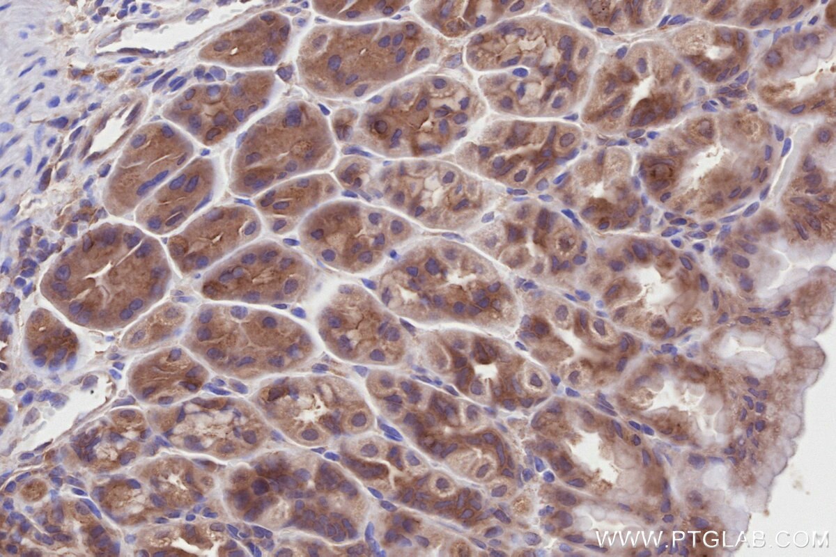 Immunohistochemistry (IHC) staining of mouse stomach tissue using DOCK7 Polyclonal antibody (13000-1-AP)