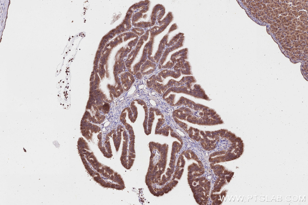 Immunohistochemistry (IHC) staining of rat ovary tissue using DOCK7 Polyclonal antibody (13000-1-AP)
