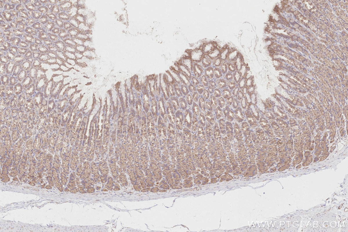 Immunohistochemistry (IHC) staining of rat stomach tissue using DOCK7 Polyclonal antibody (13000-1-AP)