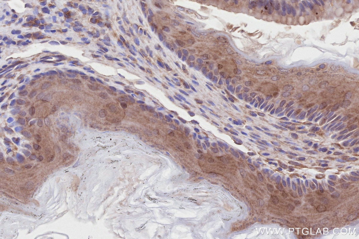 Immunohistochemistry (IHC) staining of mouse stomach tissue using DOCK7 Polyclonal antibody (13000-1-AP)