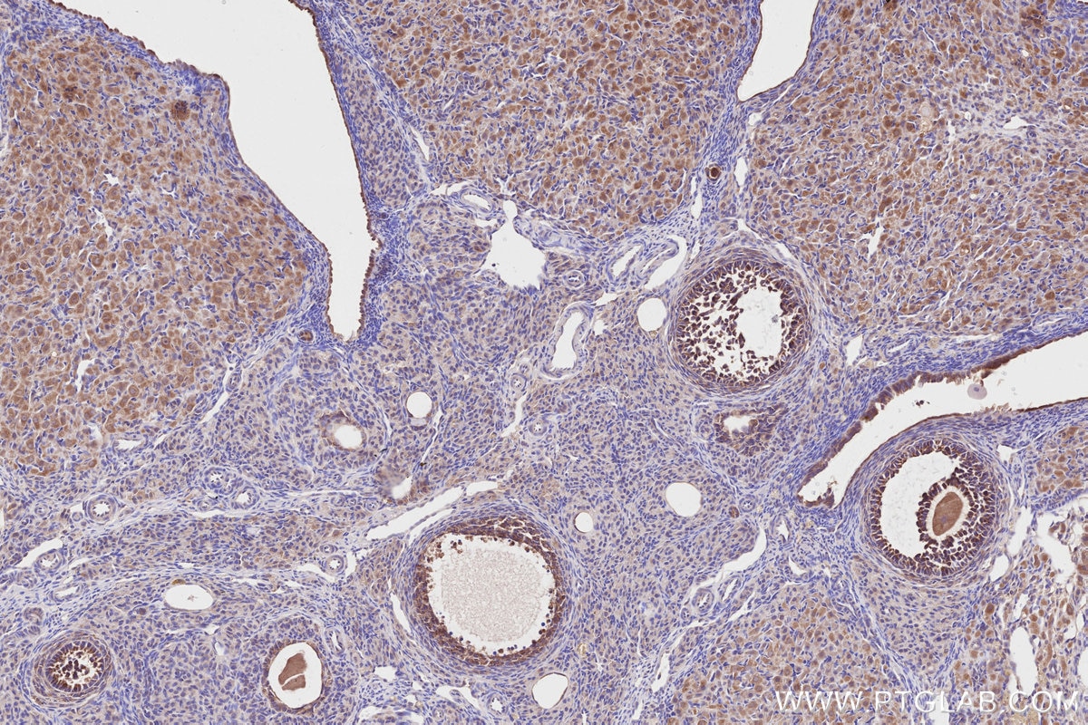 Immunohistochemistry (IHC) staining of rat ovary tissue using DOCK7 Polyclonal antibody (13000-1-AP)