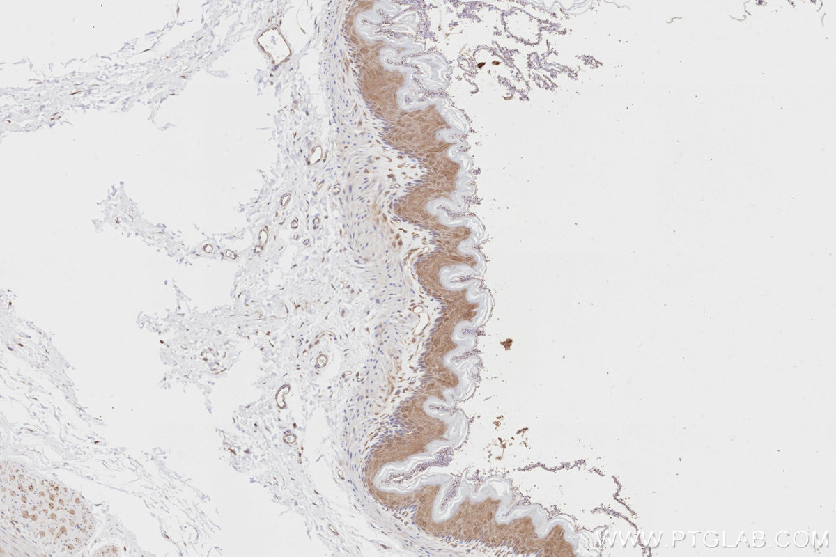 Immunohistochemistry (IHC) staining of rat stomach tissue using DOCK7 Polyclonal antibody (13000-1-AP)