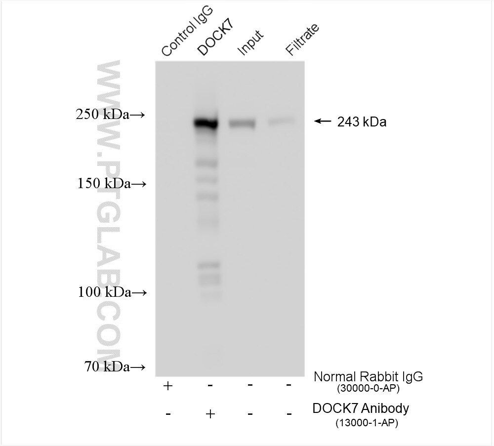 IP experiment of HeLa using 13000-1-AP