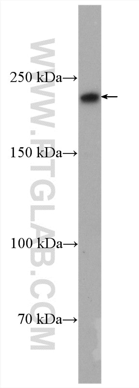 Western Blot (WB) analysis of mouse brain tissue using DOCK7 Polyclonal antibody (13000-1-AP)