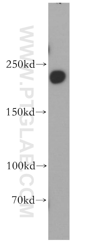 Western Blot (WB) analysis of human brain tissue using DOCK7 Polyclonal antibody (13000-1-AP)