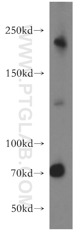 Western Blot (WB) analysis of mouse ovary tissue using DOCK7 Polyclonal antibody (13000-1-AP)