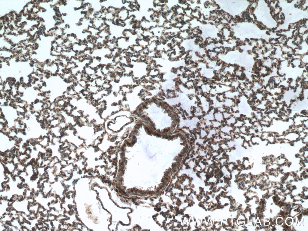 Immunohistochemistry (IHC) staining of mouse lung tissue using DOCK8 Polyclonal antibody (11622-1-AP)