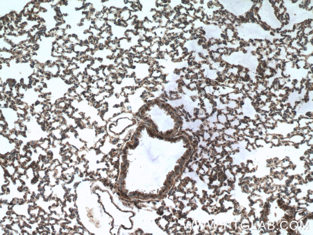 IHC staining of mouse lung using 11622-1-AP