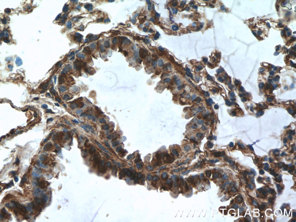 Immunohistochemistry (IHC) staining of mouse lung tissue using DOCK8 Polyclonal antibody (11622-1-AP)