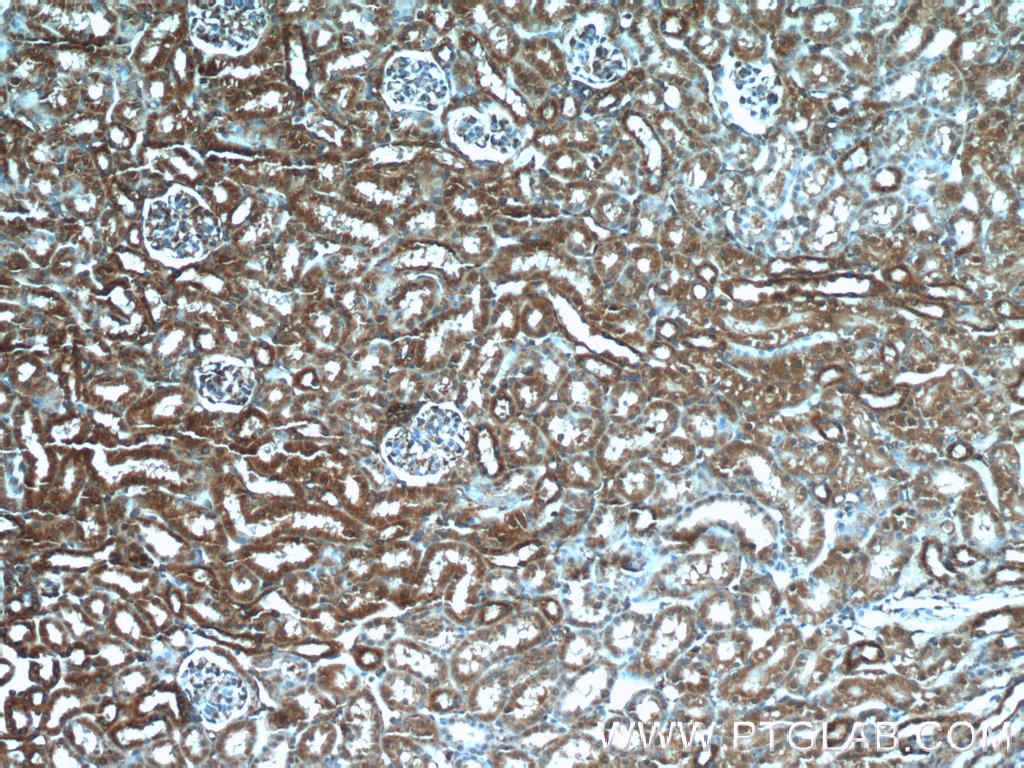 Immunohistochemistry (IHC) staining of mouse kidney tissue using DOCK8 Polyclonal antibody (11622-1-AP)
