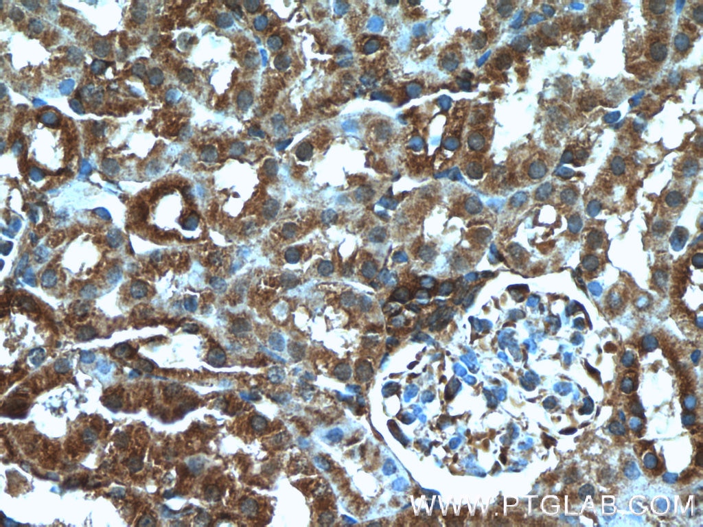 Immunohistochemistry (IHC) staining of mouse kidney tissue using DOCK8 Polyclonal antibody (11622-1-AP)