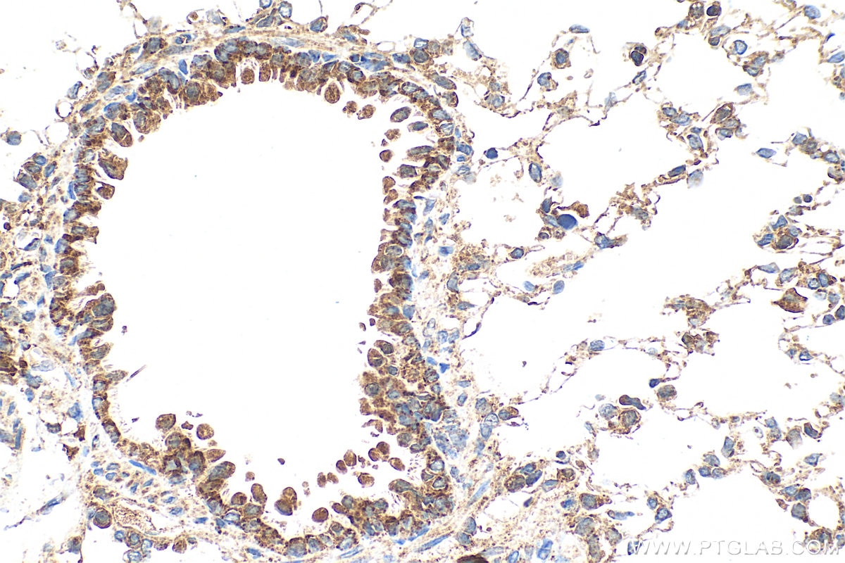 Immunohistochemistry (IHC) staining of rat lung tissue using DOCK8 Polyclonal antibody (11622-1-AP)