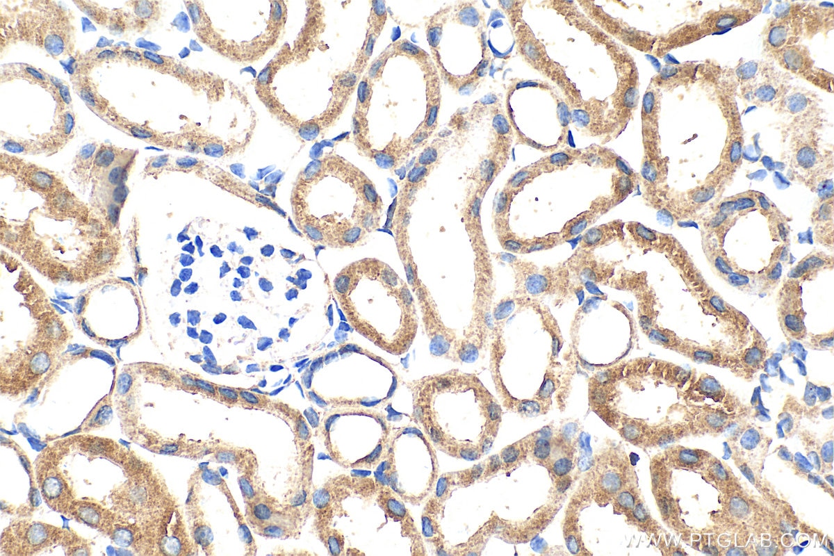 Immunohistochemistry (IHC) staining of mouse kidney tissue using DOCK8 Polyclonal antibody (11622-1-AP)