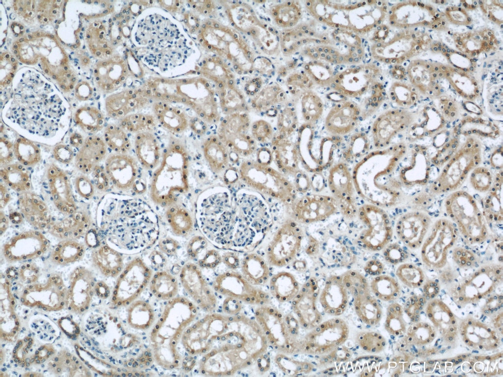 Immunohistochemistry (IHC) staining of human kidney tissue using DOCK8 Polyclonal antibody (11622-1-AP)