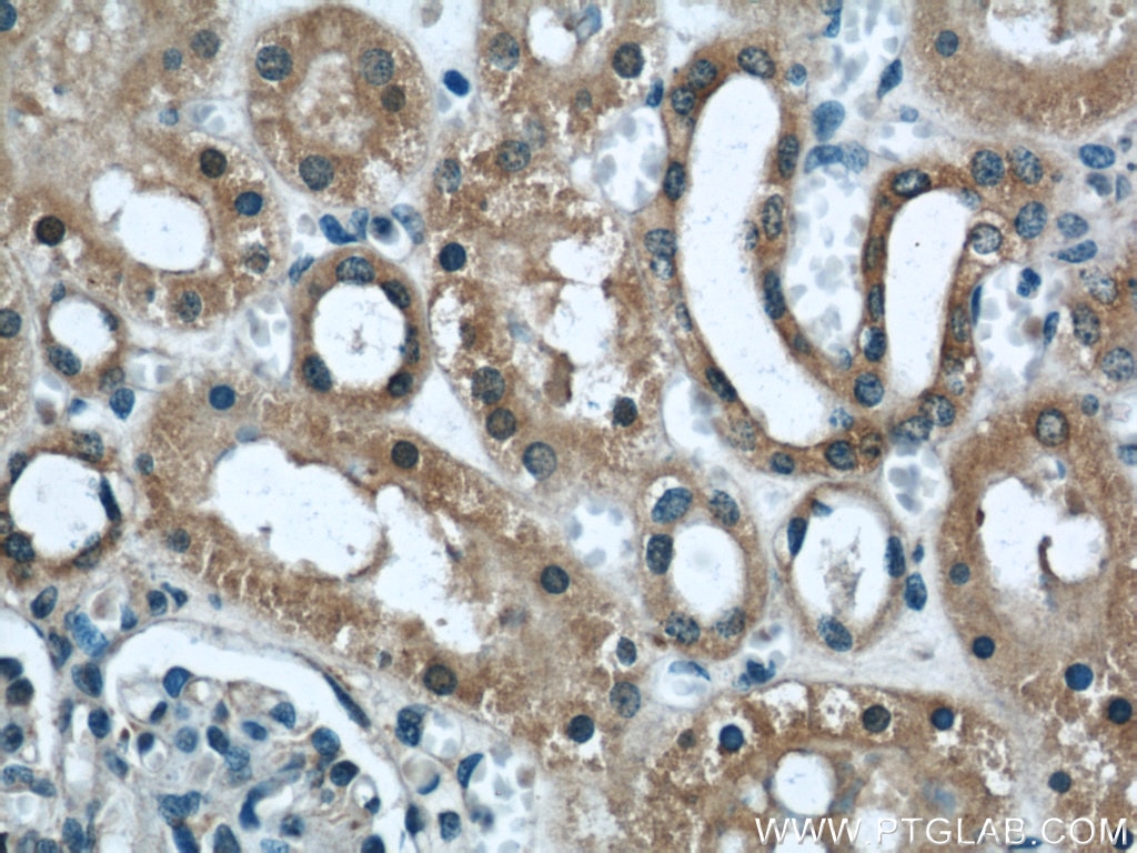 Immunohistochemistry (IHC) staining of human kidney tissue using DOCK8 Polyclonal antibody (11622-1-AP)