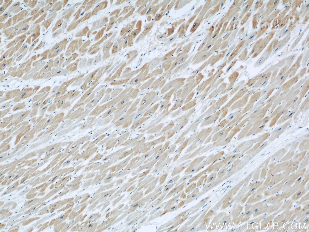 Immunohistochemistry (IHC) staining of human heart tissue using DOCK8 Polyclonal antibody (11622-1-AP)